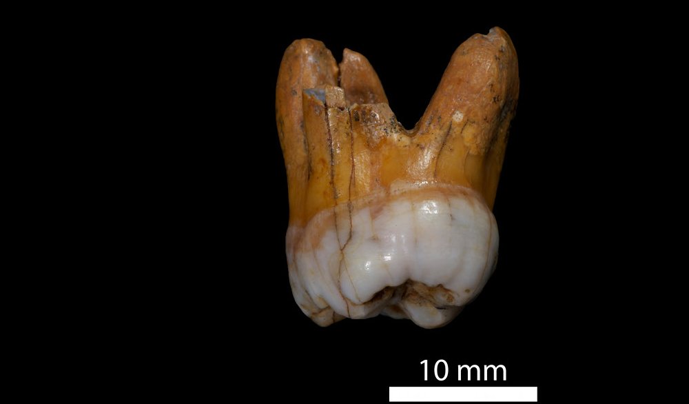 Denisova molar, distal. Image courtesy of Max Planck Institute for Evolutionary Anthropology