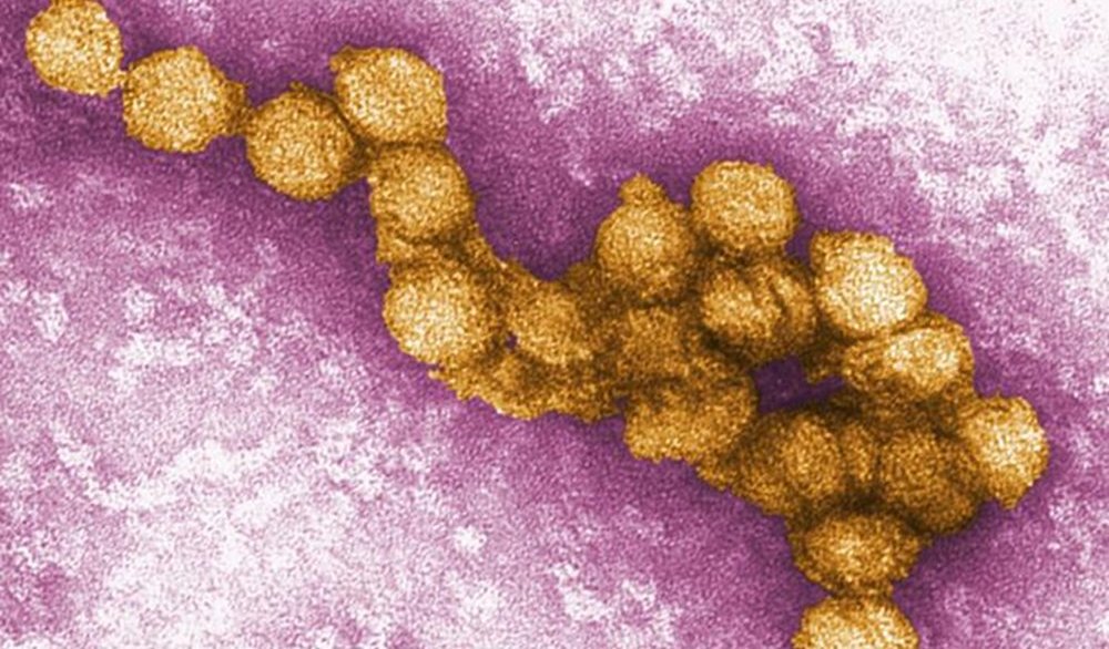 Close up of a digitally-colorized transmission electron micrograph (TEM) of the West Nile virus (WNV). Image courtesy of Cynthia Goldsmith and CDC/P.E. Rollin