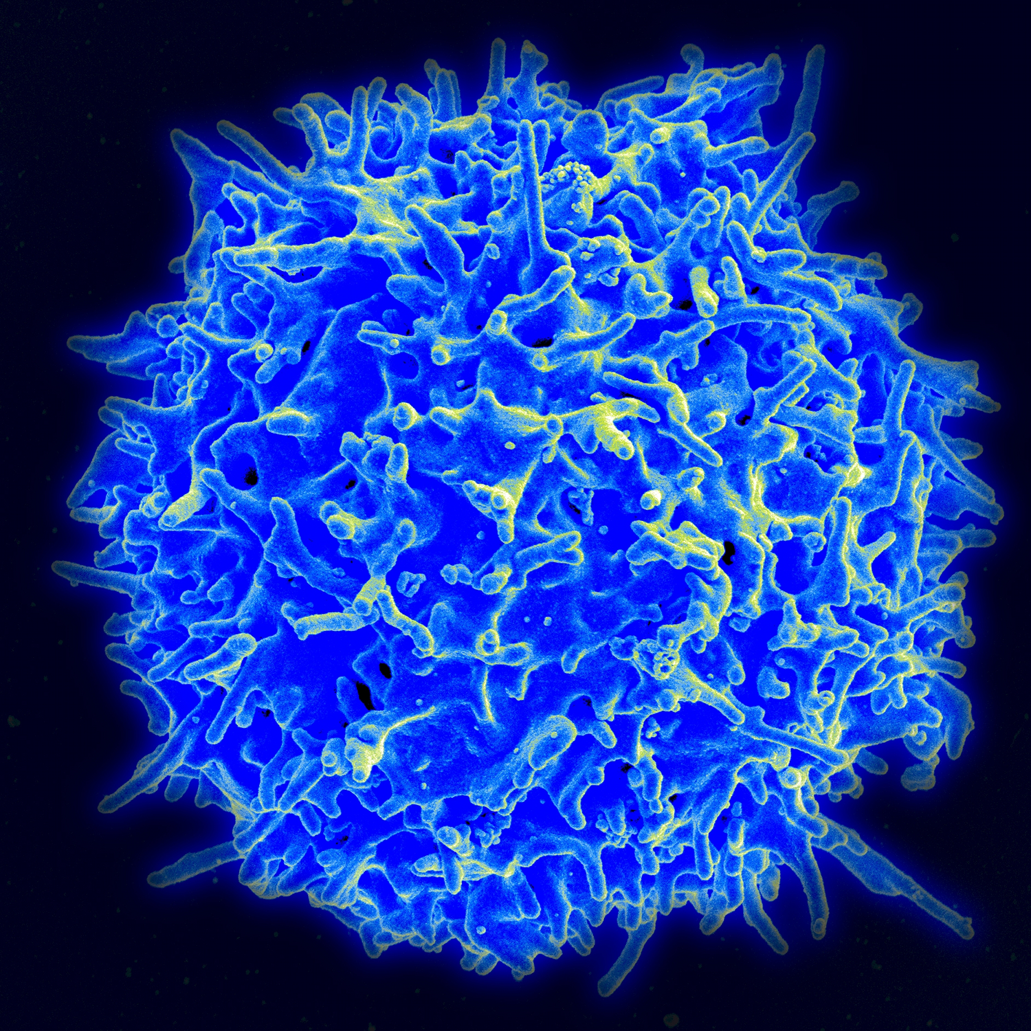 Scanning electron micrograph of a human T lymphocyte (also called a T cell) from the immune system of a healthy donor. Image by NIAID