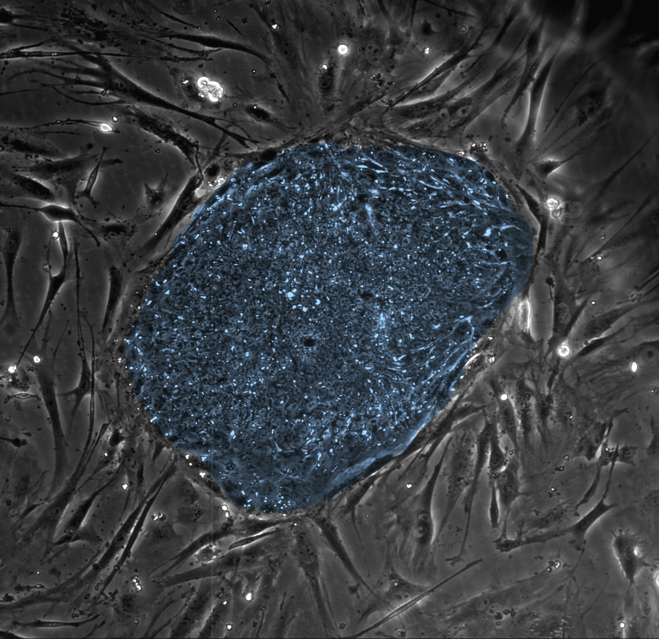 A colony of human embryonic stem cells (center, blue) from the lab of the University of Wisconsin-Madison's James Thomson. These cells, which arise at the earliest stages of development, are blank slate cells capable of differentiating into any of the 220 types of cells or tissues in the human body, and can provide access to tissue and cells for basic research and potential therapies. Photo by Clay Glennon/Thomson Lab, used with permission by UW-Madison University Communications 