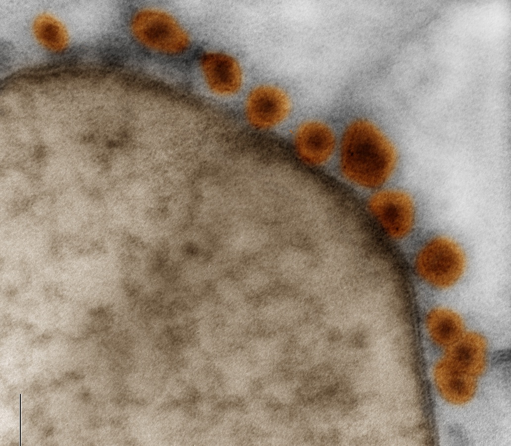 Electron microscopy of Zika virus (orange) bound to cell membrane (brown) in neurosphere generated from human induced pluripotent stem cells. Photo by Credit: Rodrigo Madeiro
