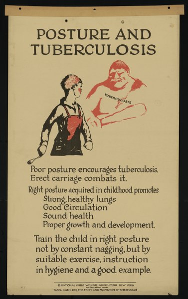 poszter fiatal ember, nagy, fenyegető ogre figyelmeztetés neki, hogy egyenesen álljon, mert "rossz testtartás ösztönzi a tb""poor posture encourages tb"