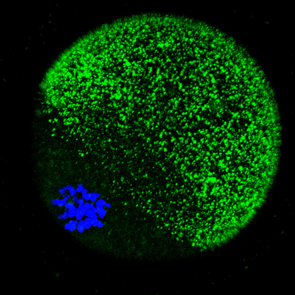 Zinc Sparks Fly When Egg Meets Sperm