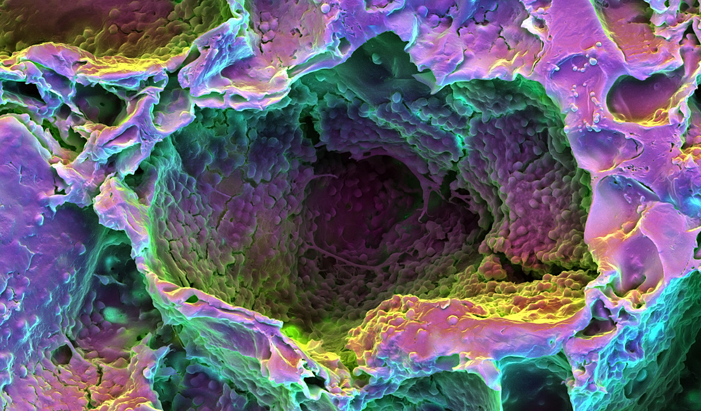 Laser Blast Can Regrow Teeth, in Rats Science Friday