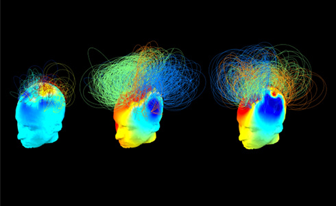 Picture of the Week: Awareness in a Damaged Brain