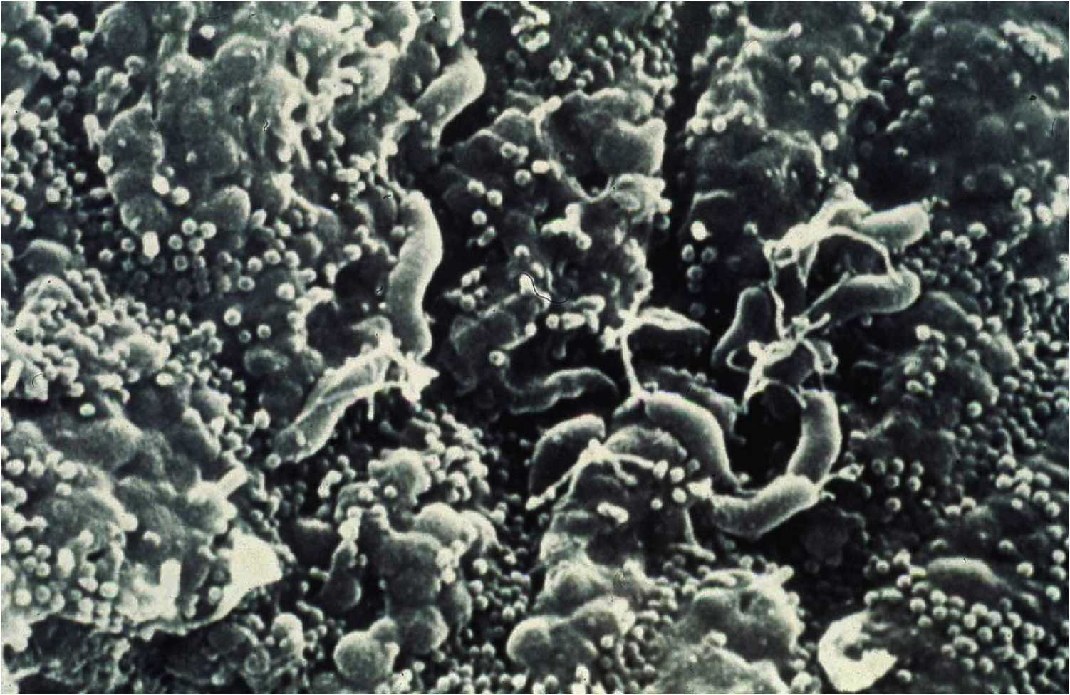Stomach Cancer Bacterium Increases Colorectal Cancer Risk - Microbiology - Labme