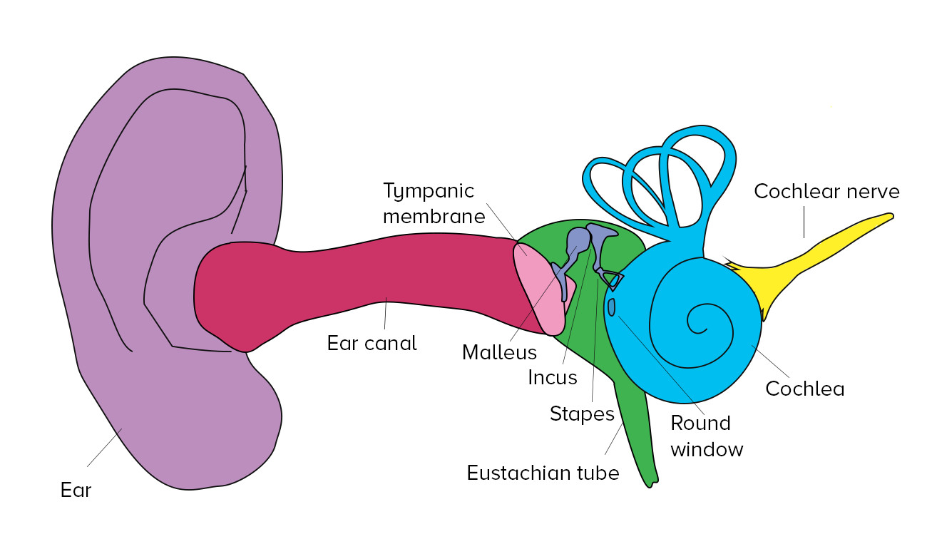 What Do Cochlear Implants And Hearing Aids Sound Like?