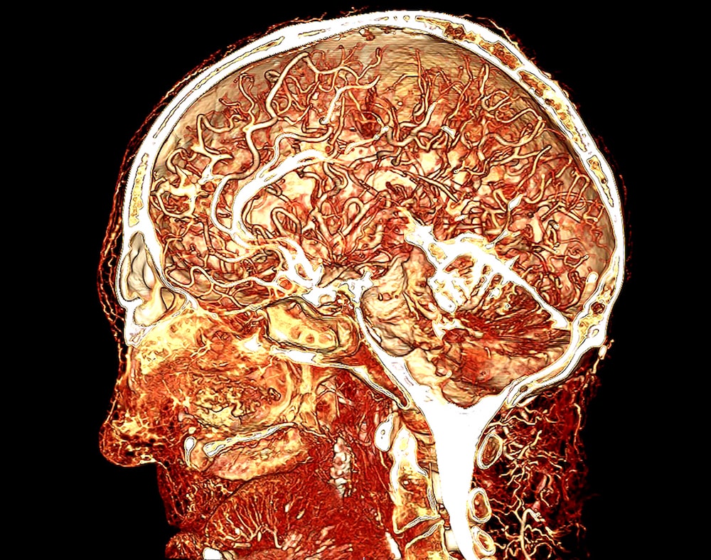 CT scan of human head and brain