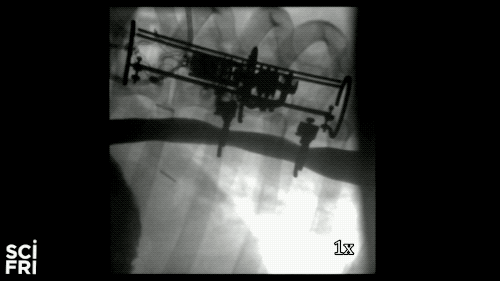 x-ray video of pig esophagus being stretched by mechanics