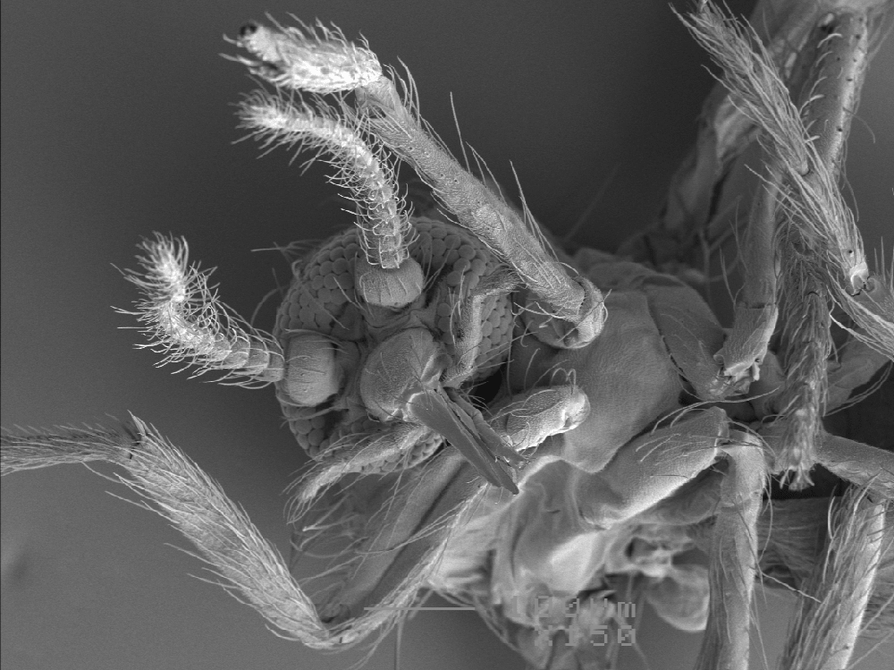 black and white image of a midge's mouth under a microscope