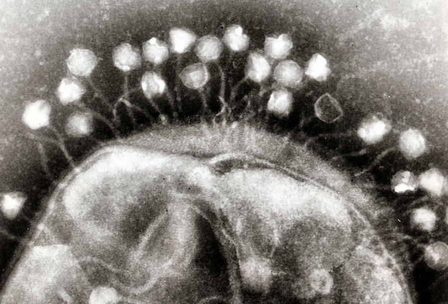 black and white photograph of dozens of white dots (phages) latching onto round cell