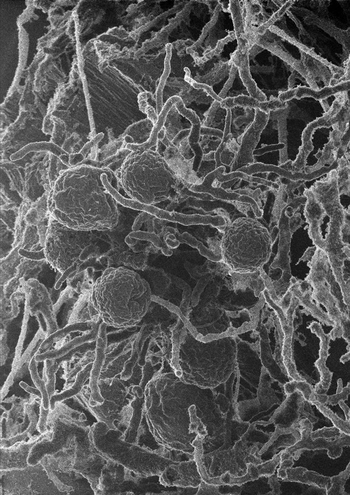 black and white microscopic image of densely packed tangle of microbes