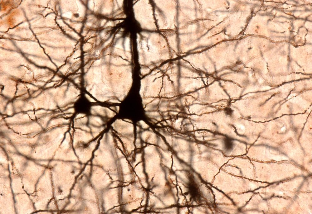 neuron stained under a microscope