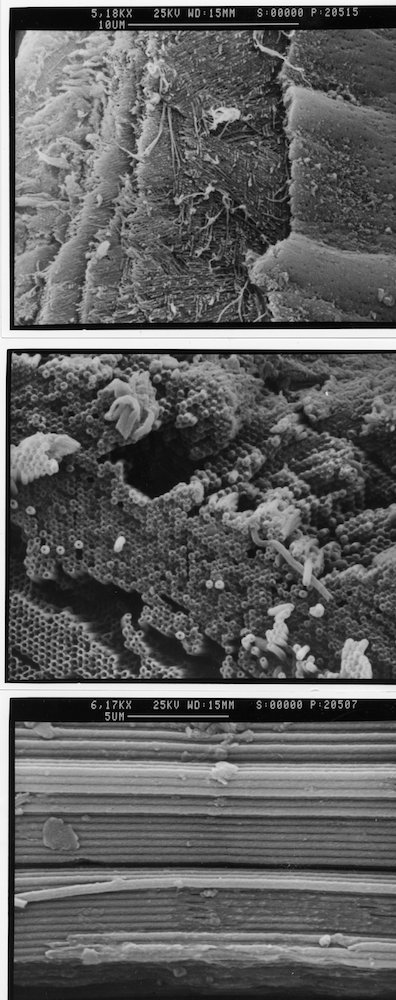 black and white electron microscope scans of the filaments