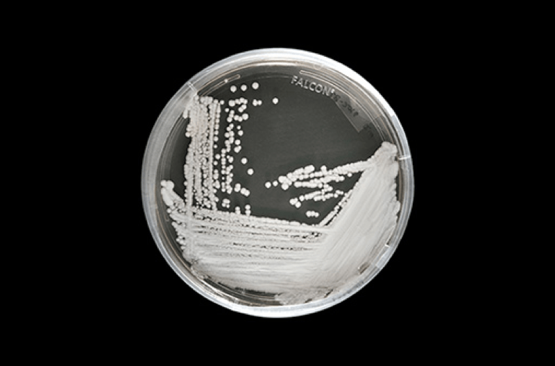a petri dish filled with white material against a black background