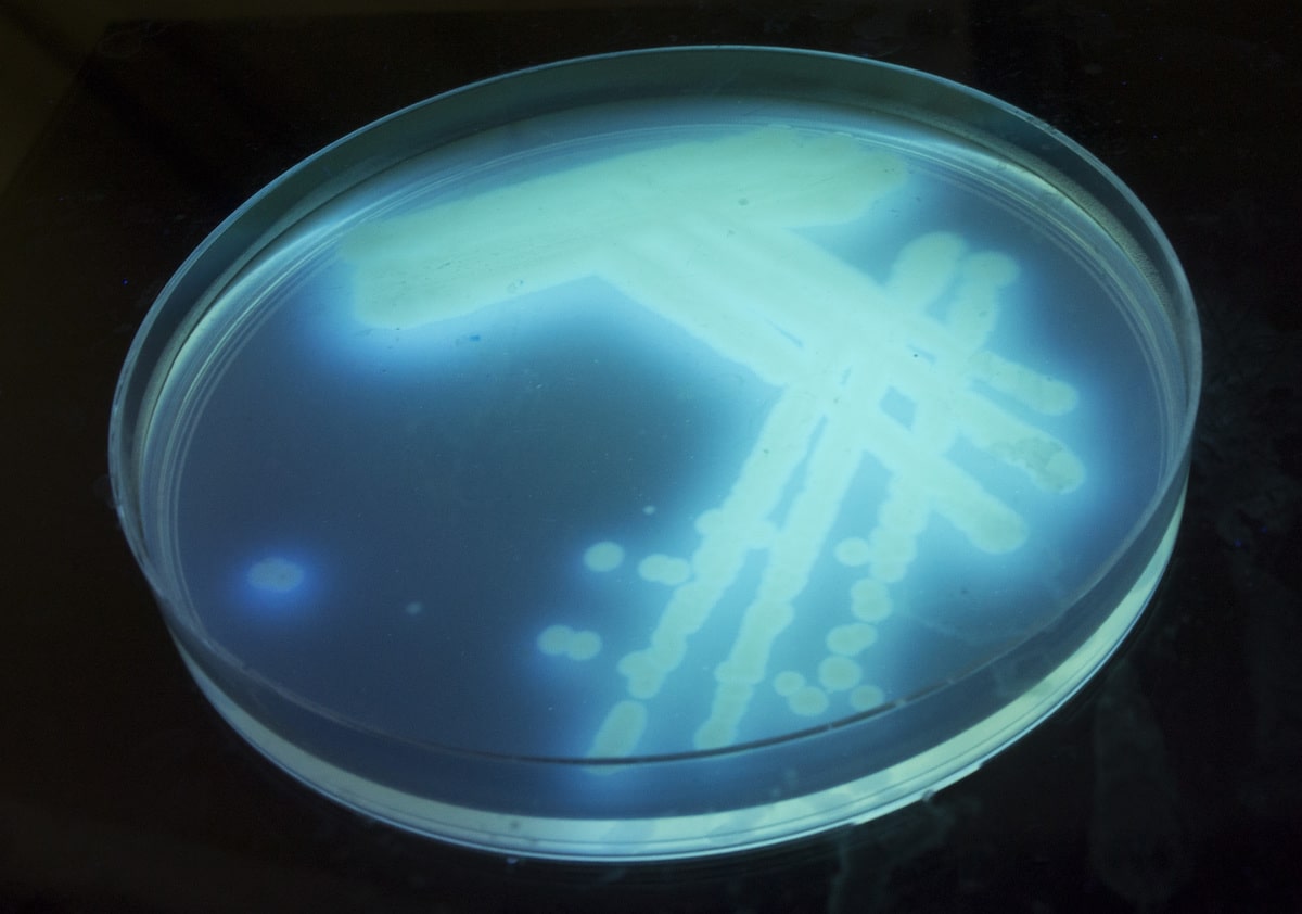 Pseudomonas aeruginosa cultivated on King B agar plate under ultraviolet light. P. aeruginosa produces fluorescent pigment pyoverdin that glows under ultraviolet light.