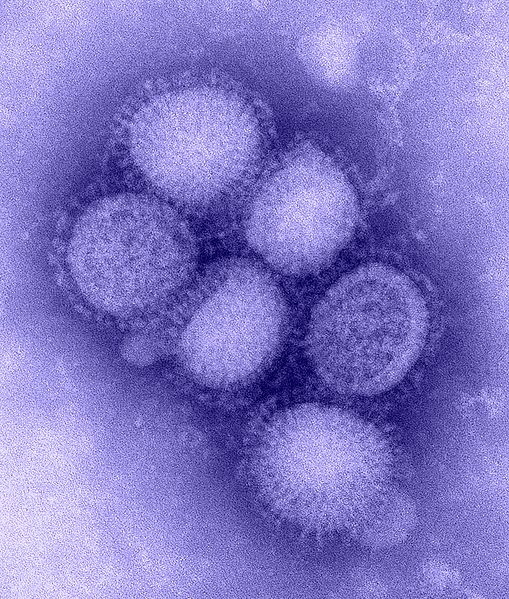 magnified image of h1n1 VIRUS. purple color enhanced image with fuzzy balls clustered together
