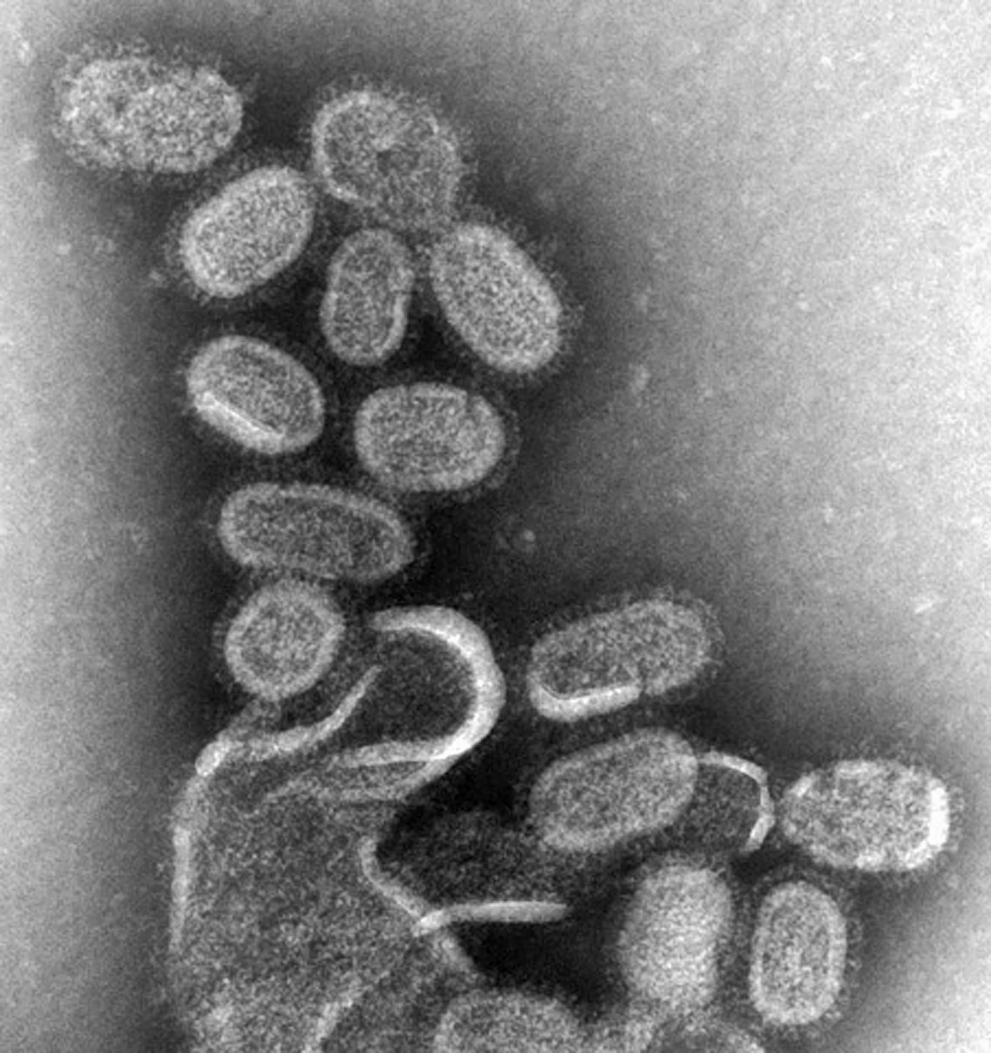black and white electron microscope image of a bunch of oval shaped viruses with spikes around the surface bursting from cell debris