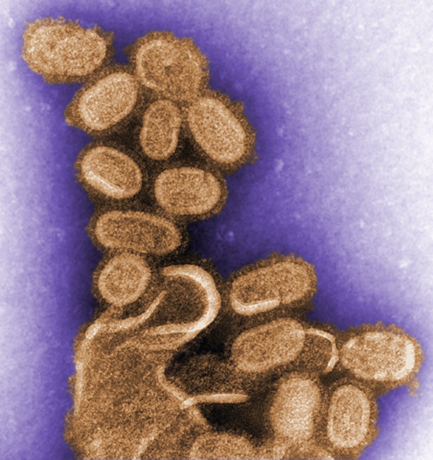 a microscope image of oval shaped viruses digitally colored in gold, bursting out of cell debris, also in gold. the background is digitally colored purple