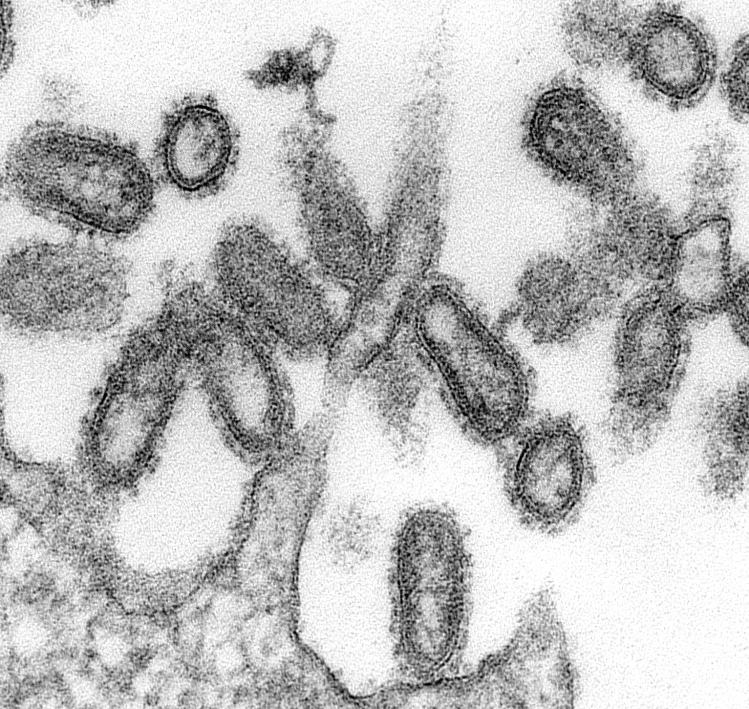 a black and white electron microscope image of viruses that are oval shaped and have fuzzy rods sticking out from the edges