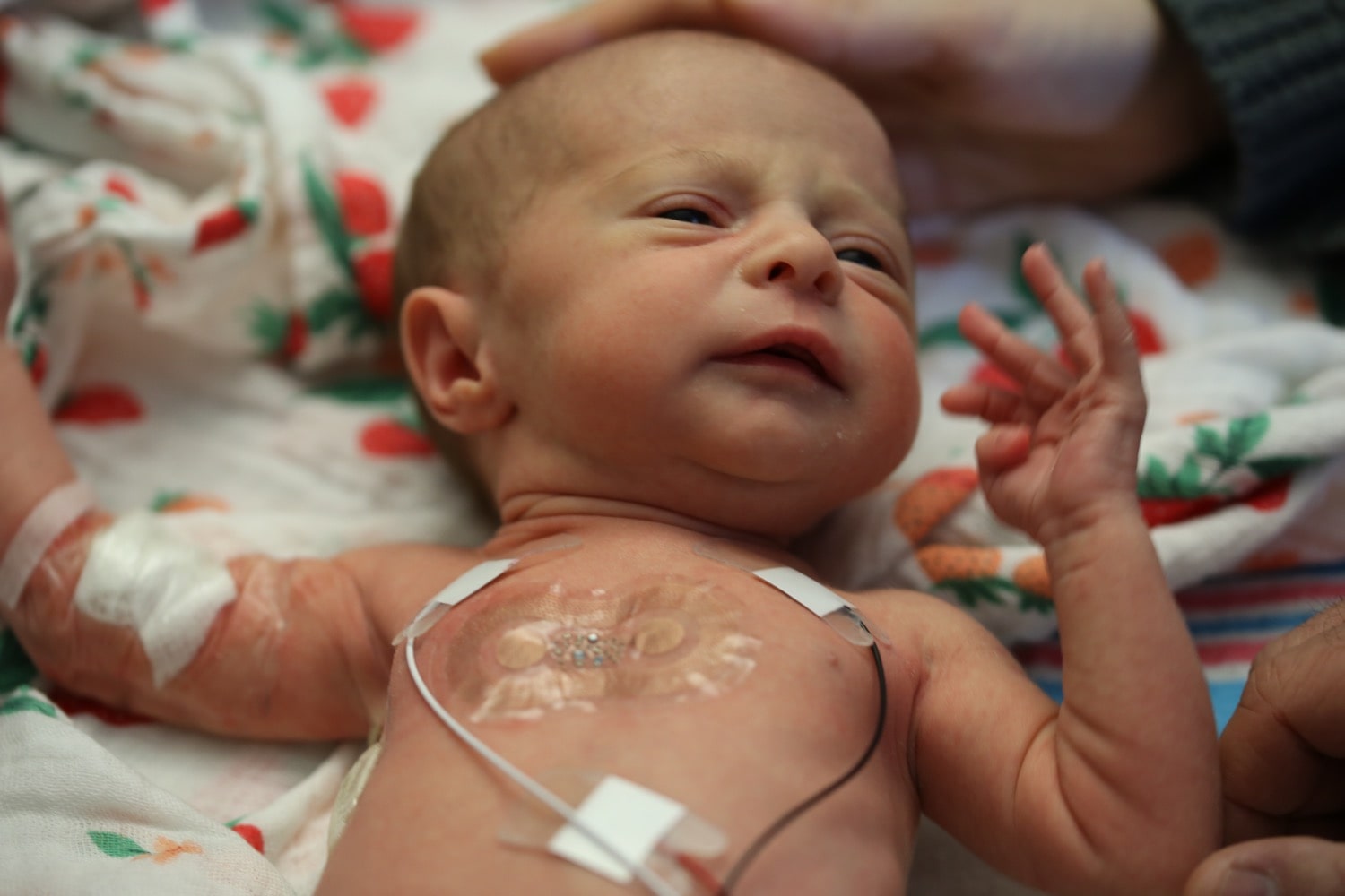 a newborn infant wears three small sensors taped to its torso along with a clear, oval shaped senser attached to the center of its chest