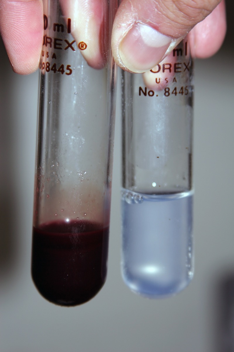How Does The Antarctic Icefish Live Without Red Blood Cells? How Does The Antarctic Icefish Live Without Red Blood Cells?