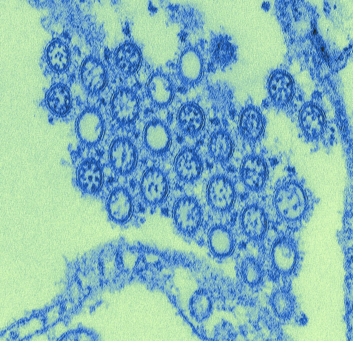 an electron microscope image of a thin section of the flu virus. there are many individual viruses seen here. the viruses are digitally colored blue and the background is a green blue