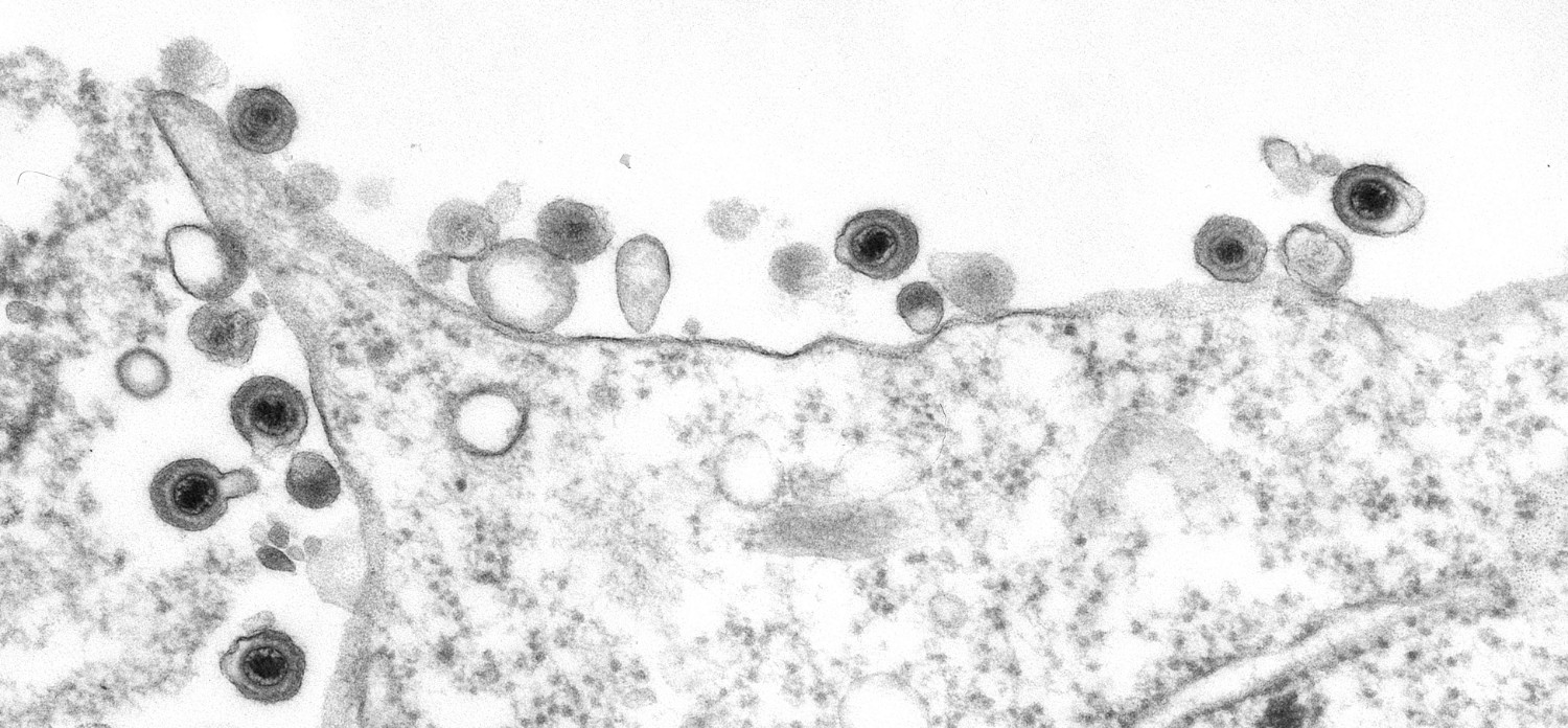 a black and white electron microscope image of the human herpesvirus that look like dark circles with even darker centers