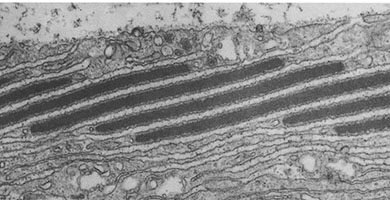 a black and white image of a microscope image. it shows a slice of tissue, detailing the long dark oval shaped cells of the iridophore