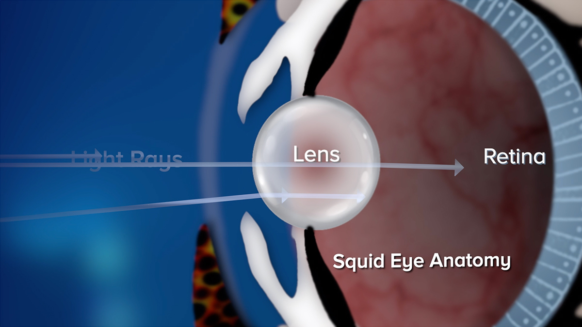 a diagram of an eye, with light rays coming from the left, passing through the lens, and back through the eye to the retina.