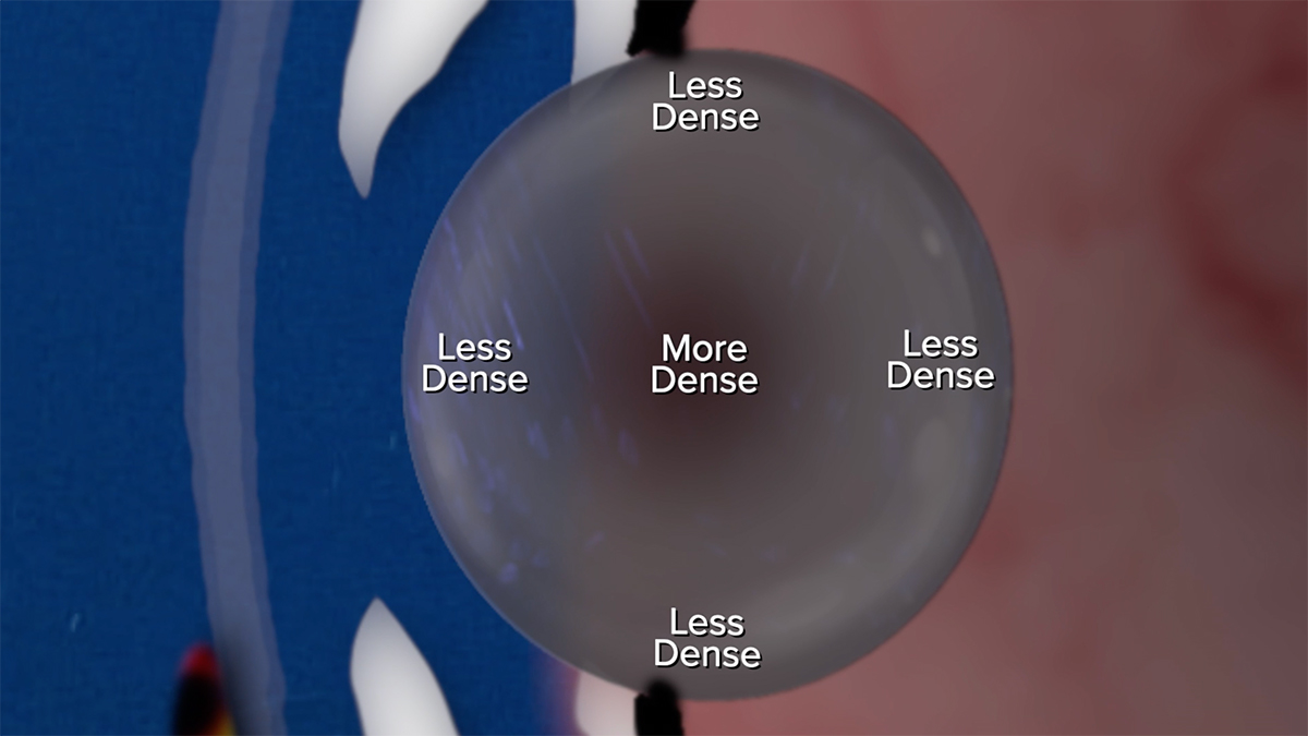 A diagram showing the density of proteins in a squid eye lens. There are less proteins on the edge of the lens, and more dense proteins in the center