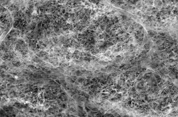 a black and white microscope image of a network of mesh, which is the mucin proteins
