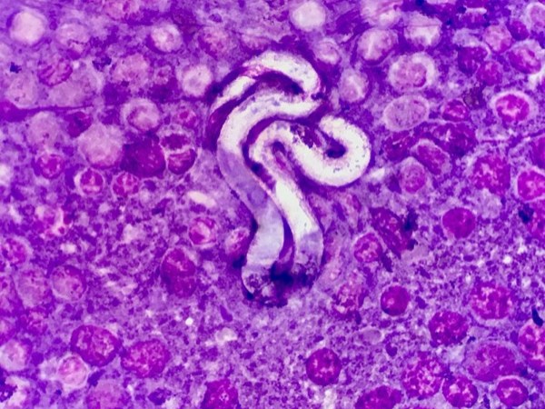 a microscopic slide. the view is purple with clearer spots indicating different cells. in the middle are two curled worms