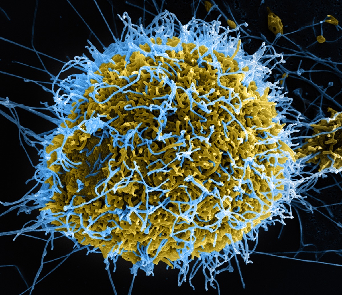a blue and yellow microscope image of the deadly ebola virus