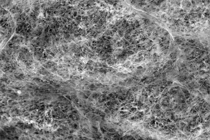 a black and white microscope image of a network of mesh, which is the mucin proteins