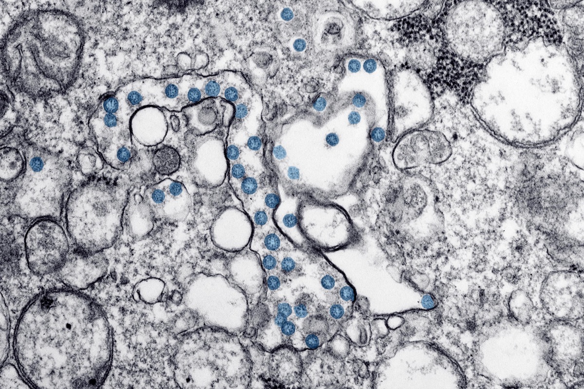 an electron microscope picture. it's colored black and white, except highlighted in blue are circular viruses