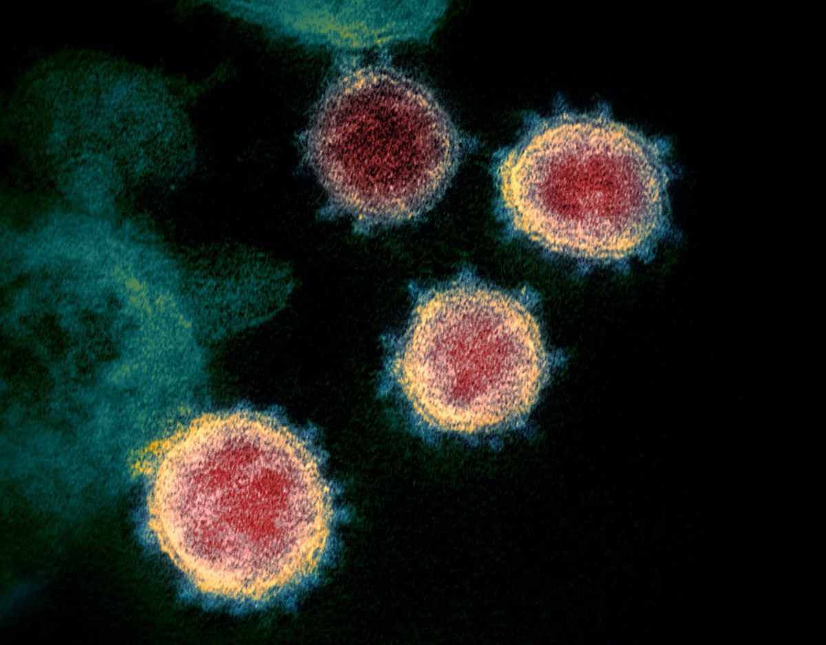 a colored image of circular viruses. the circles are pink in the center and orange on the outside. its edges have small spikes protruding from them