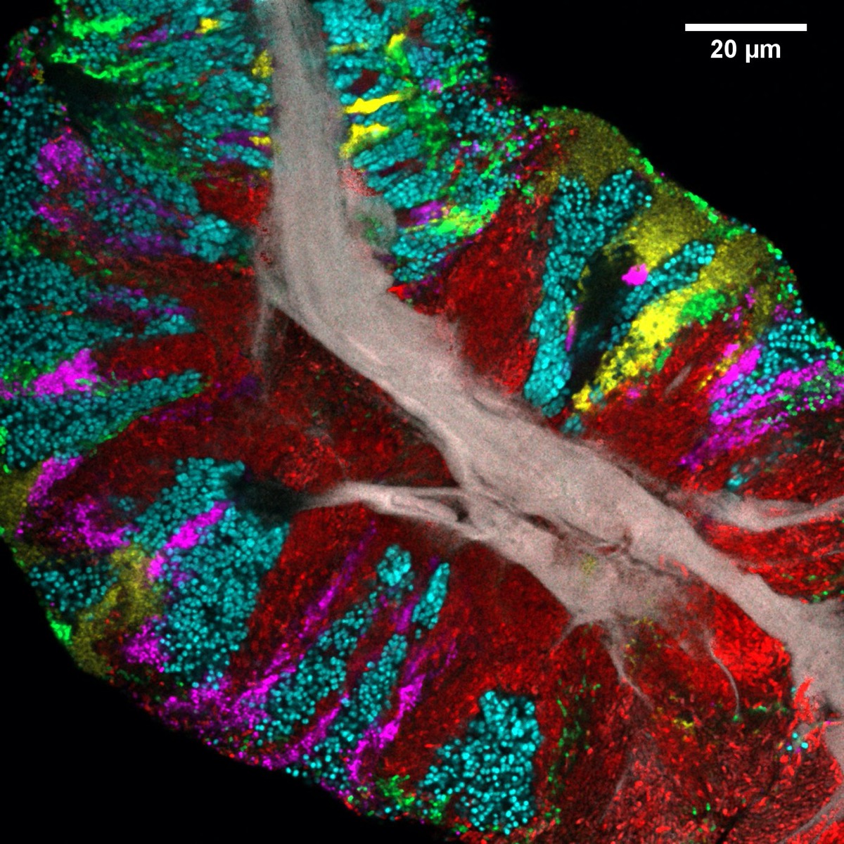 a human tongue that has been imaged, resulting in patches of various colors over certain regions of the tongue.