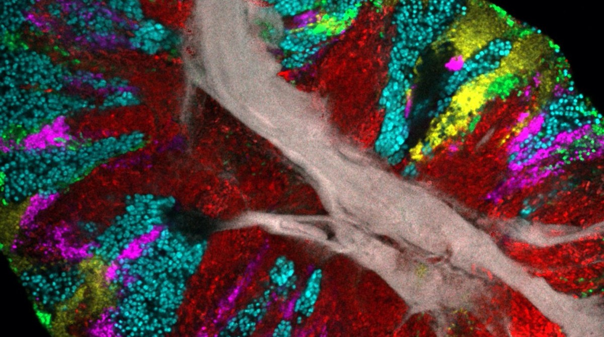 a human tongue that has been imaged, resulting in patches of various colors over certain regions of the tongue.