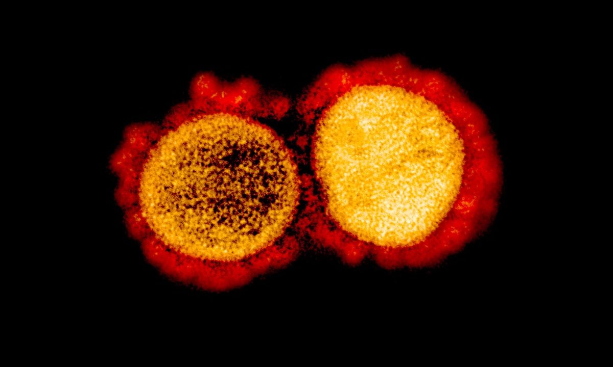 a microscope image of two circles (the two virus particles) slightly overlapping with each other. they are colored orange and yellow.