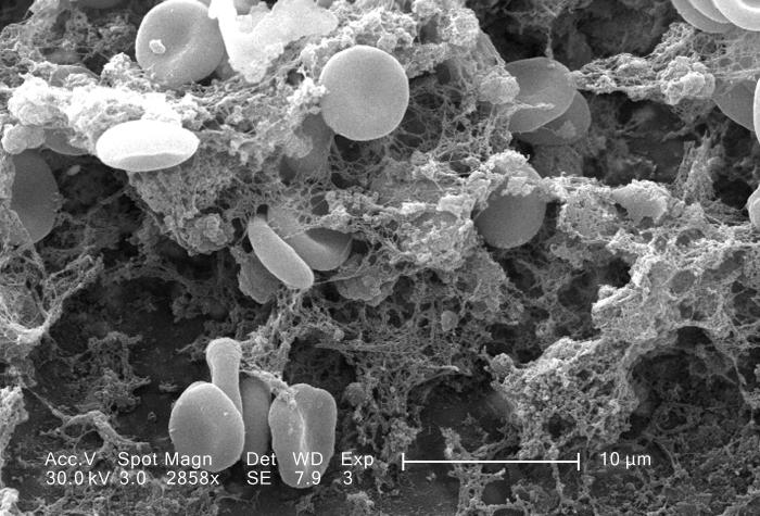 an electron microscope image of blood cells