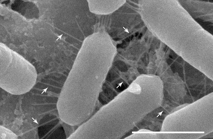 a black and white microscope image of cylinder shaped bacteria