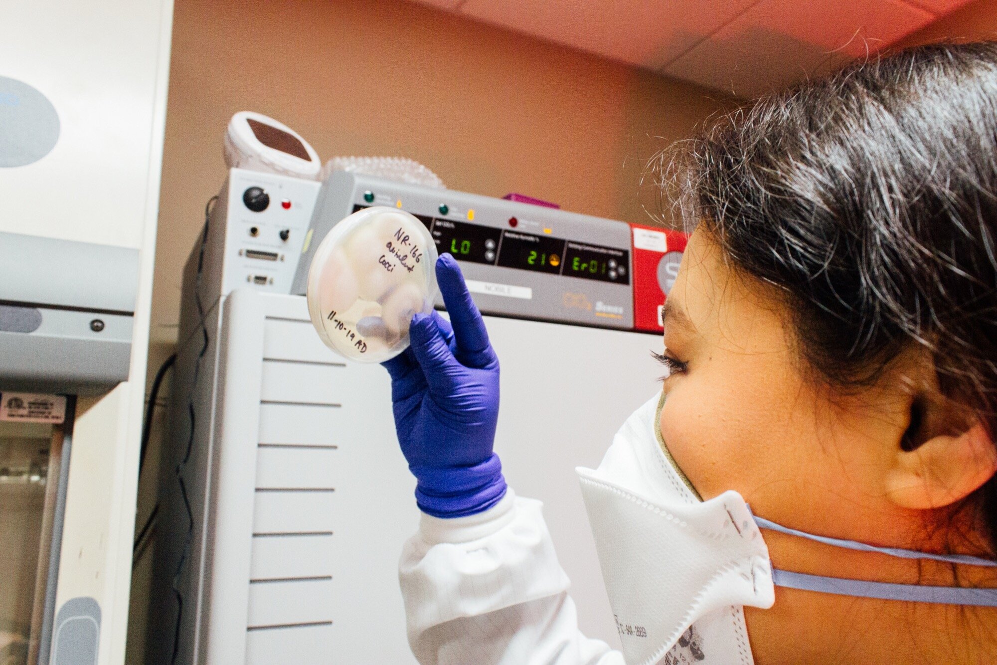 an asian woman wearing a medical mask, in gloves, and in a lab coat holds up a petri dish covered in white puffy fungus