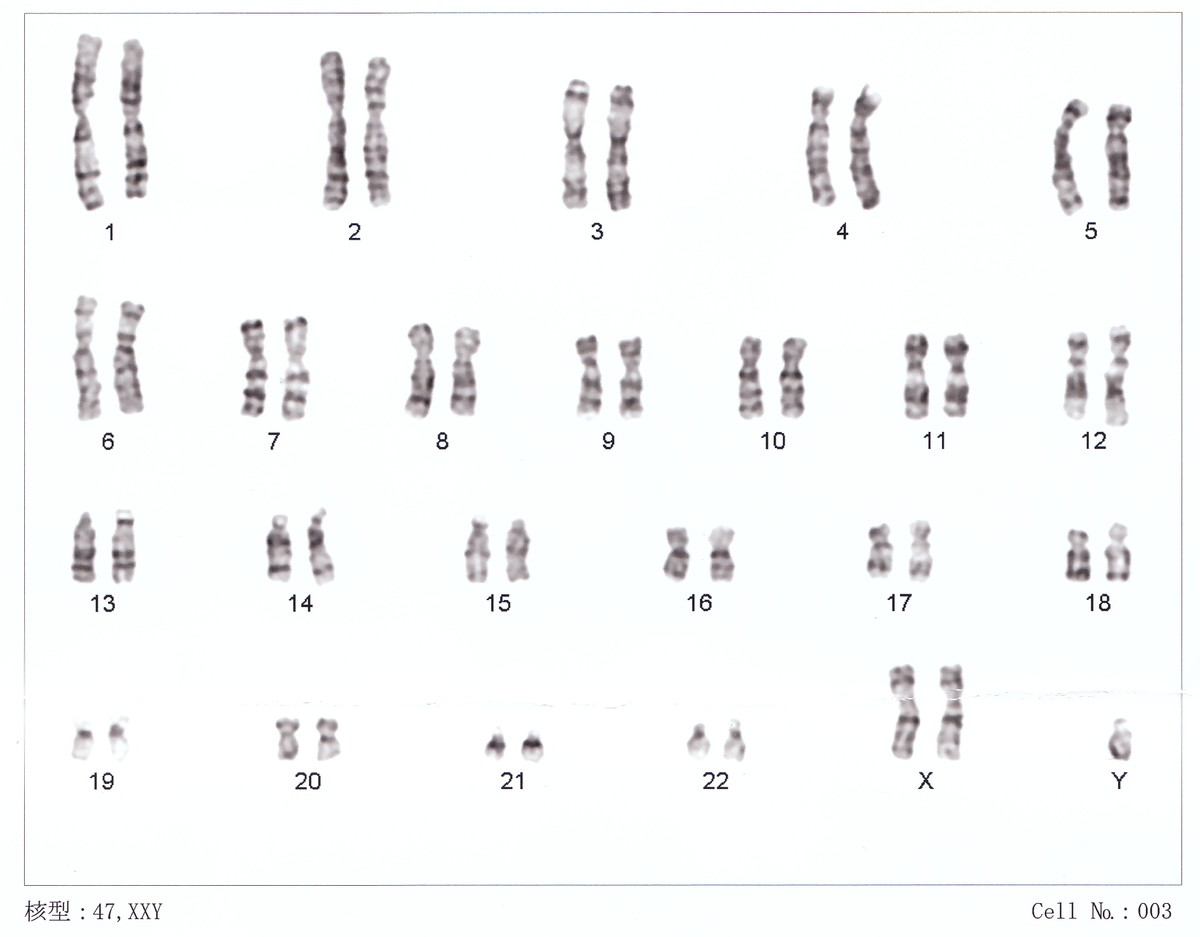 a black and white image of human chromosomes