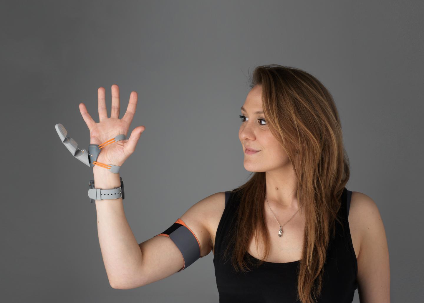 a white woman holds up her right hand. a prosthetic additional thumb is attached to the opposite side of her right hand, accompanied by some wires leading to a strap around her bicep