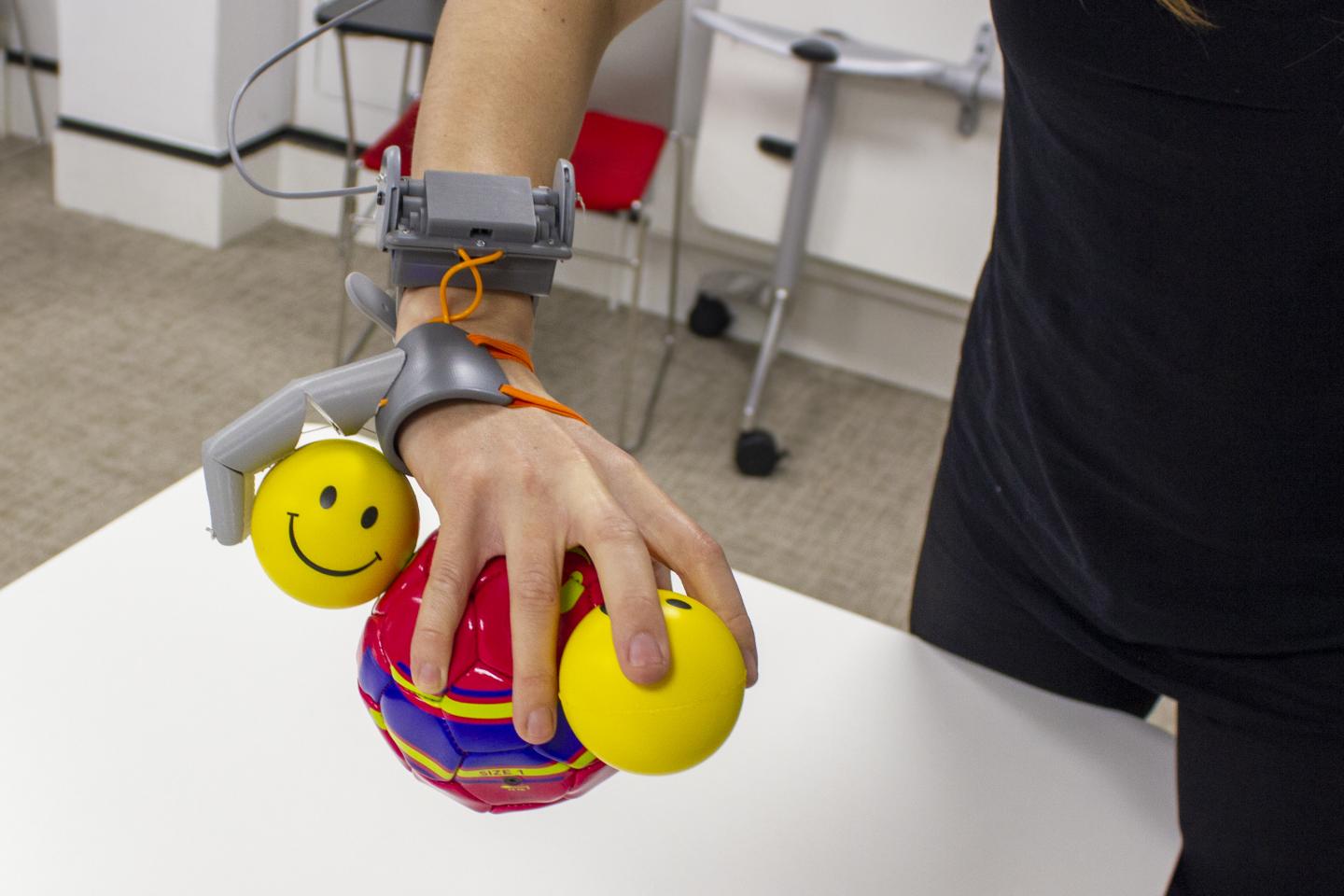 a white arm with the additional thumb prosthetic attached, allowing the user to carry a large and small ball in their main hand and holding an additional small ball thanks to the extra thumb