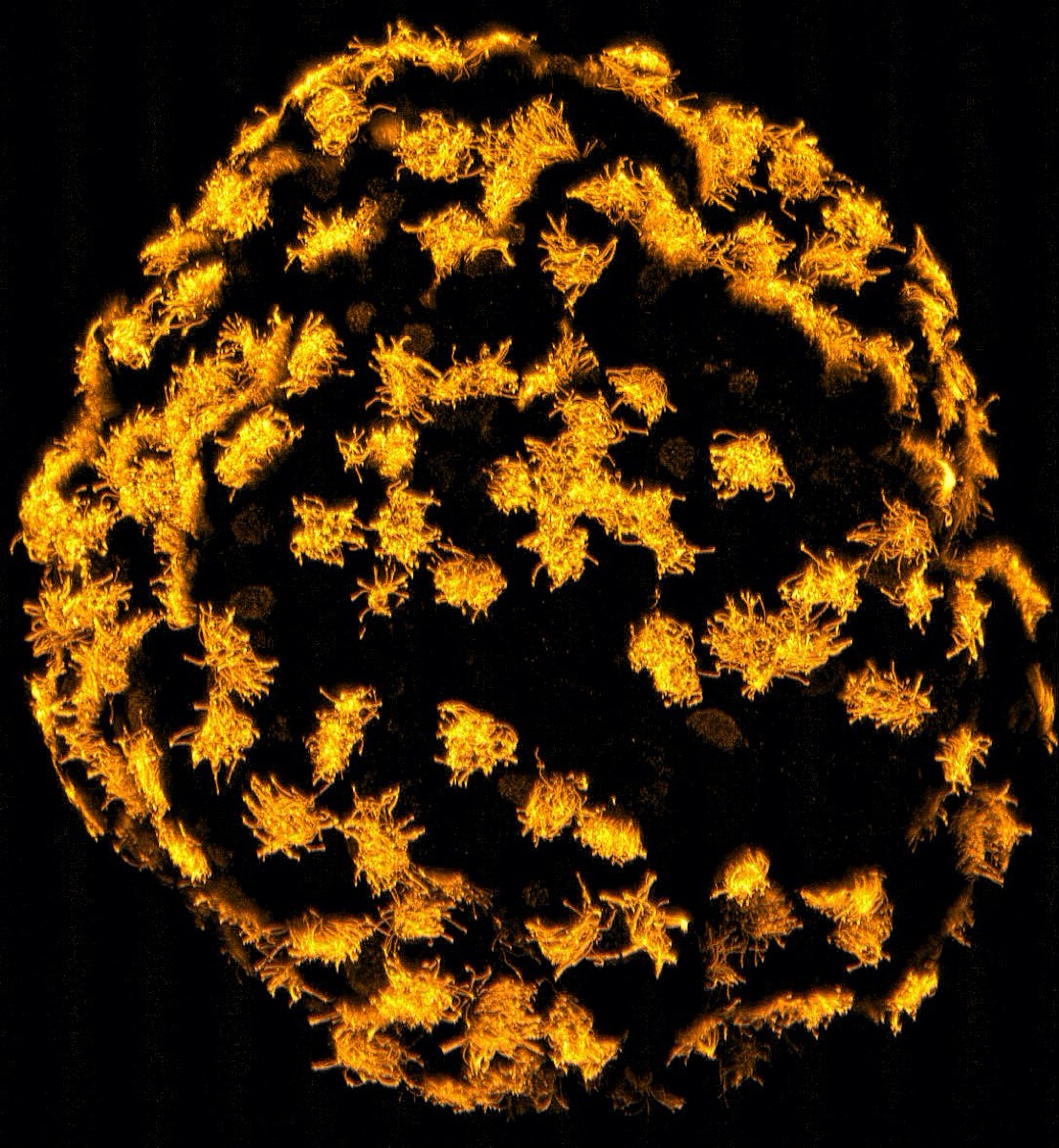 yellow cells with filamentous projections all arranged in a spherical pattern