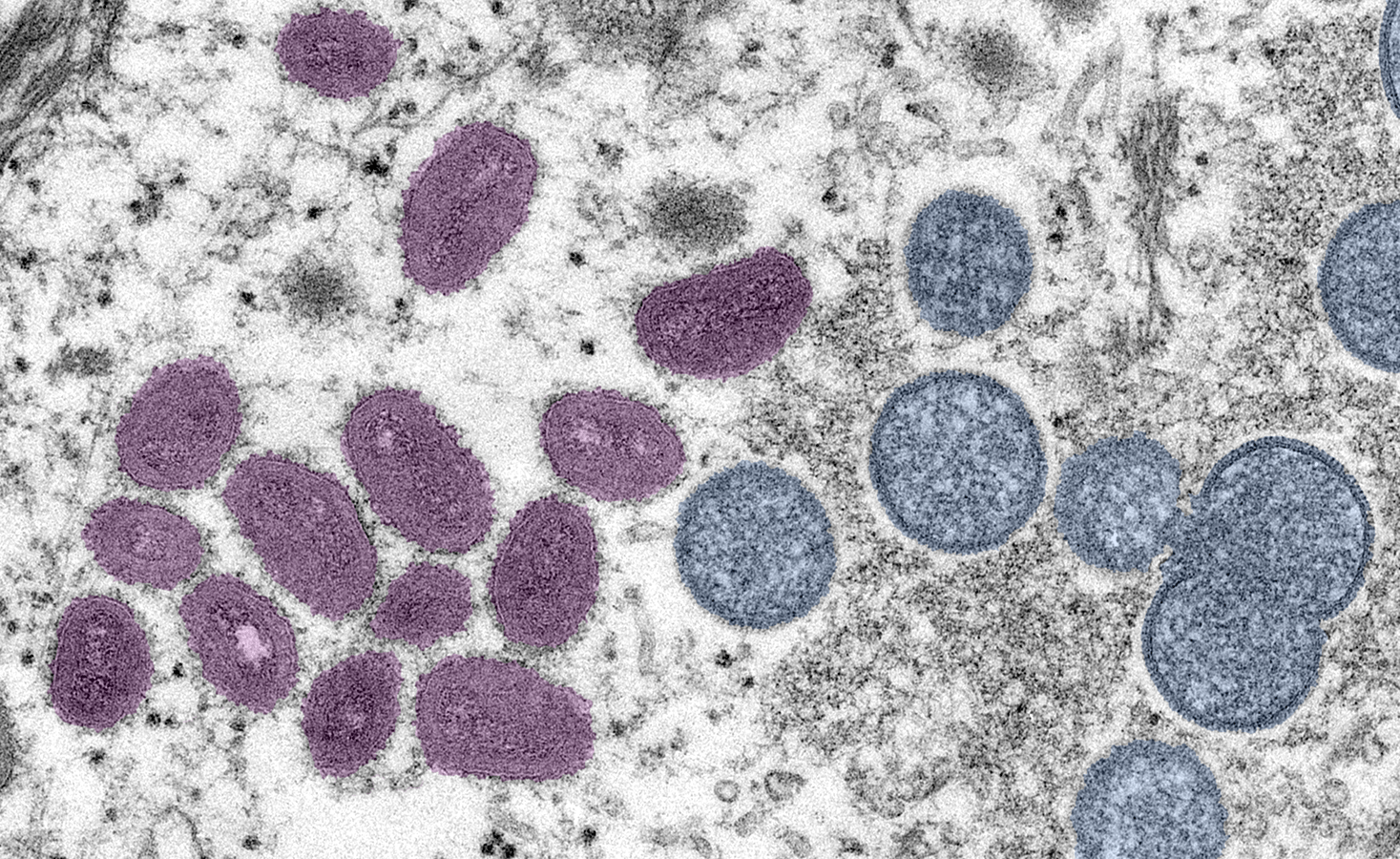 a microscopic image of monkeypox cells. they are artificially colored in two groups, purple and blue