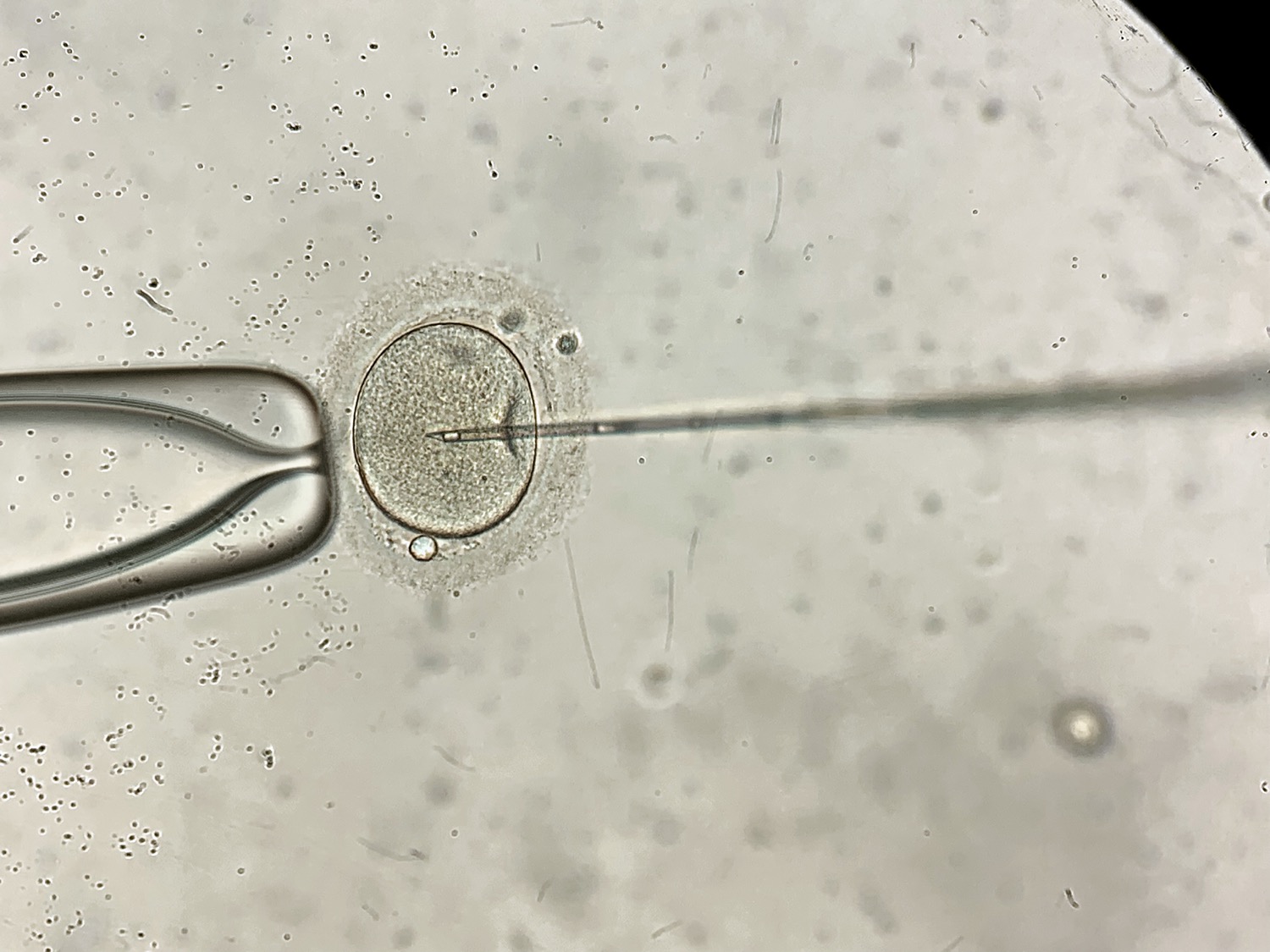 a microscopic image of a needle being inserted into a human egg a female egg on an IVF dish