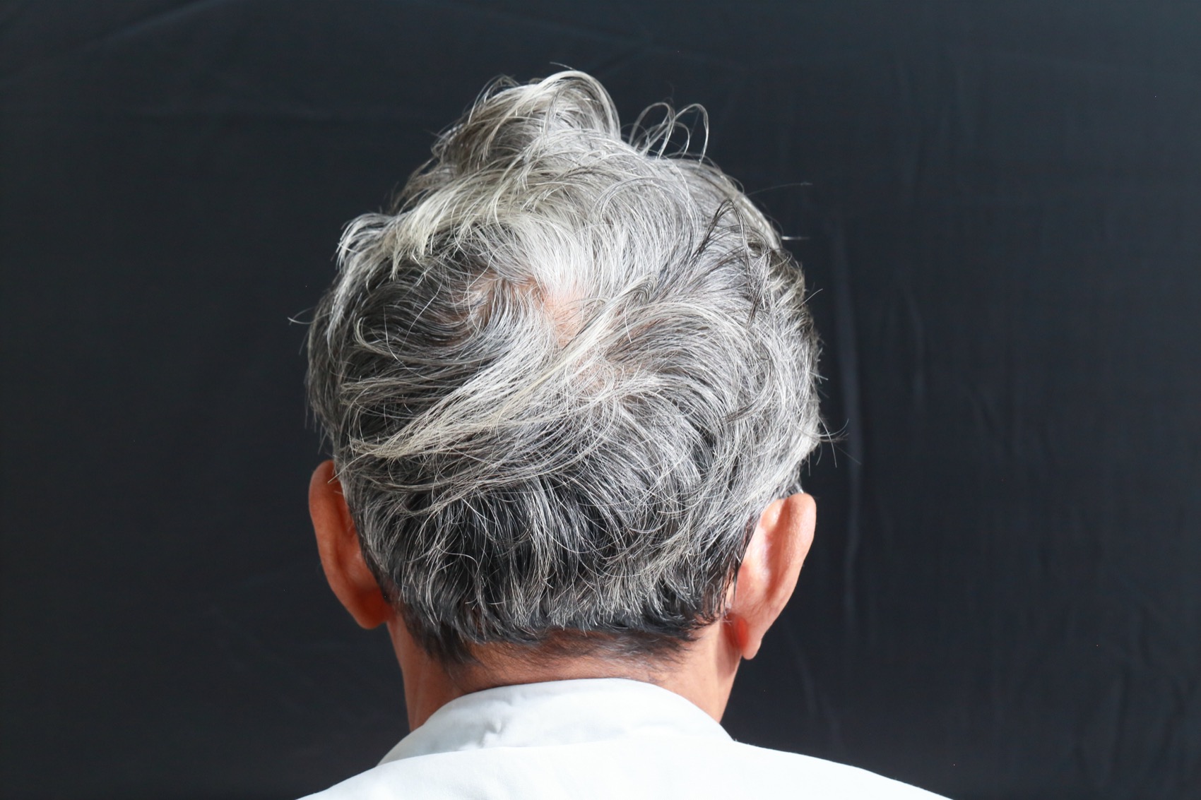 looking at the back of an old persons head filled with mostly white and some grey hair, against a black background